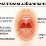 Симптомы, лечение и причины отека гортани у взрослых, оказание первой помощи