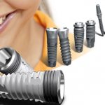 symptoms of implant rejection