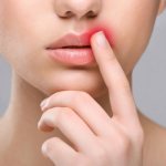 Сколько держится отек после увеличения губ гиалуроновой кислотой и как от него избавиться?