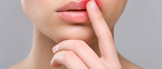 Сколько держится отек после увеличения губ гиалуроновой кислотой и как от него избавиться?