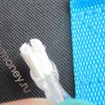 Сколько дней болят зубы после установки брекетов