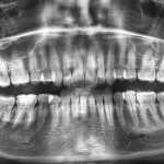 Снимок зубов