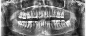 Photo of teeth
