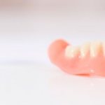 service life of dentures