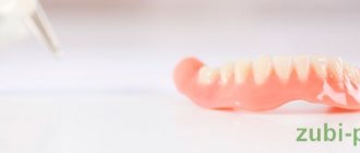 service life of dentures