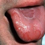 Странный симптом