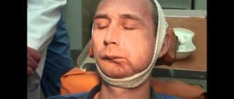 Токсический остеомиелит