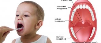 У ребенка увеличенные миндалины: лечение. Что делать?