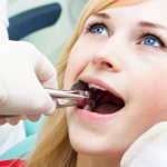 tooth extraction