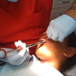 injection in the gum