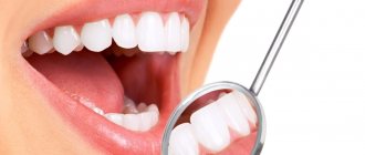 ультразвуковая чистка зубов и противопоказания к ней