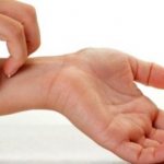 Волдыри на теле чешутся, как укусы: причины, методы лечения, отзывы