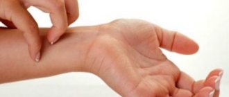 Волдыри на теле чешутся, как укусы: причины, методы лечения, отзывы