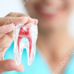 Воспаление нерва зуба