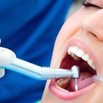 Temporary filling: how long can you walk with such material, and why is it placed?