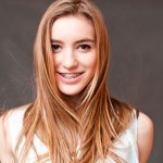 Everything about installing braces: preparation, process, adaptation