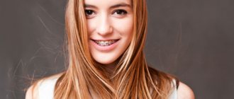 Everything about installing braces: preparation, process, adaptation