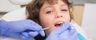 Dental diseases in children: 5 most common and dangerous diseases