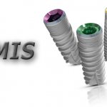 Знакомимся с израильскими имплантами MIS...