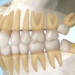 зуб мудрости зачем он нужен